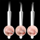 Professional Facial Blackhead Remover Tweezers, Extractor Acne Removal Kit Pimple Popper Tool