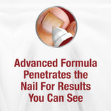 Kerasal Nail Fungal Nail Renewal Treatment for Discolored or Damaged Nails 10ml (0.33oz)