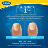 Dr. Scholl's Fungal Nail Revitalizer Led Light-activated Therapy Erase Toenail Discoloration Fungus