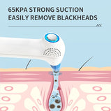 1pc Blackhead Remover Pore Vacuum Hot & Cold Compress; Blackhead Remover Pore Vacuum; Upgraded Facial Pore Cleaner