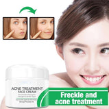 Anti Stains Acne Treatment Cream Scar Blackhead Face Cream Shrink Pores Whitening Skin Care Face Cream Korean Cosmetics