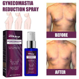 Cellulite Melting Spray Weight Loss Spray 30 ML Breast Firming Gynecomastia Reduction Spray For Men Women Body Care