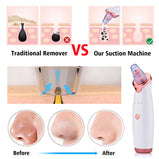 Blackhead Remover Instrument Black Dot Remover Acne Vacuum Suction Face Clean Black Head Pore Cleaning Beauty Skin Care Tool